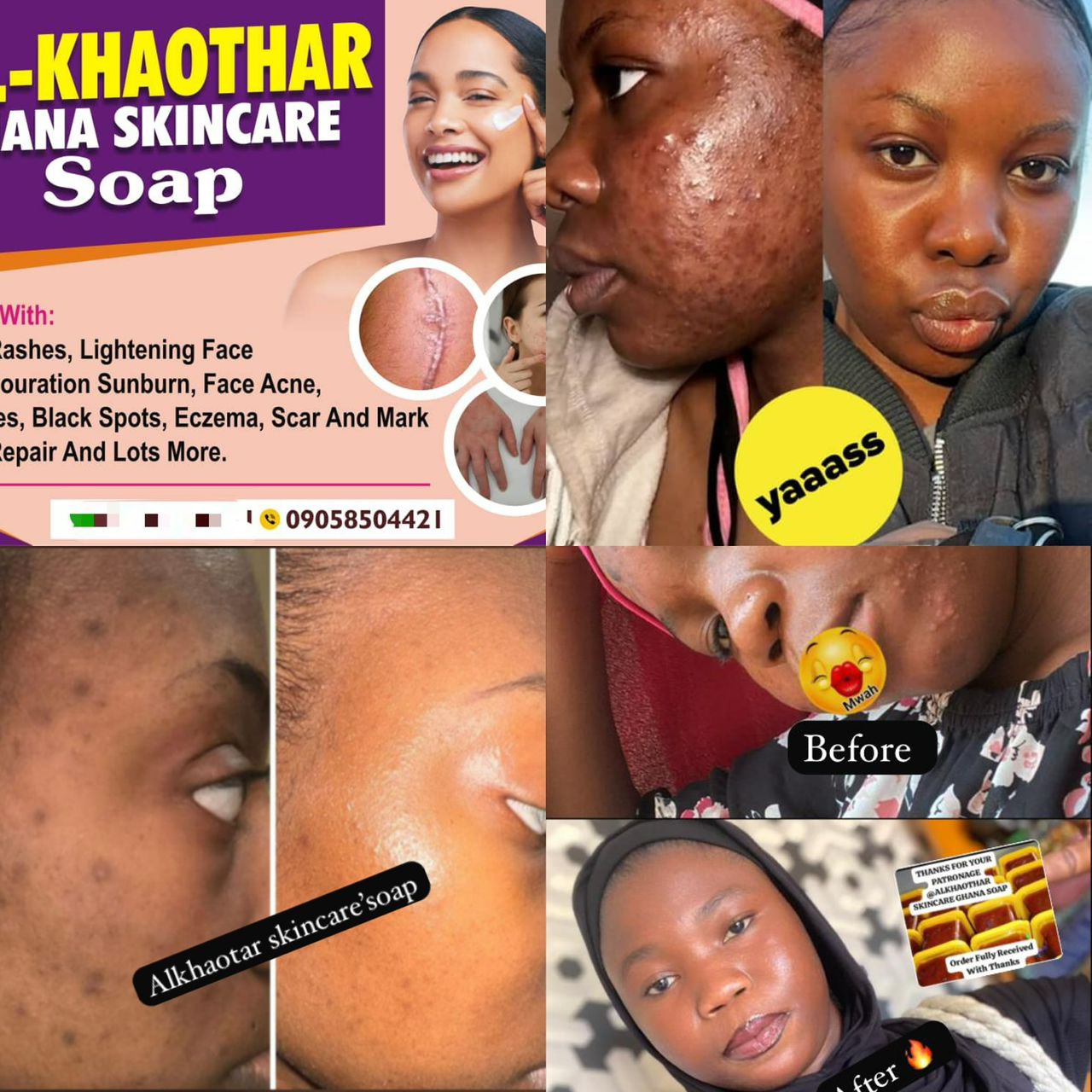 Alkhaothar Ghana Skincare Soap